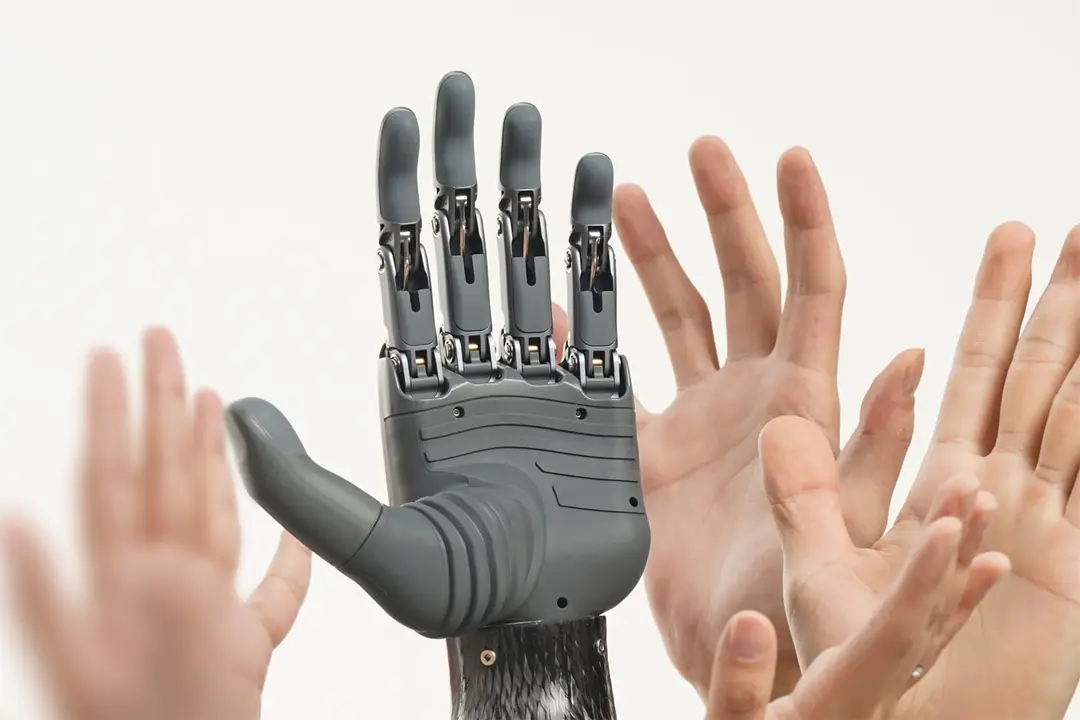 Photograph shows a bionic hand developed by BrainCo with human hands in the background