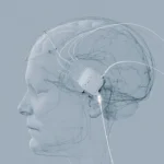 Concept illustration of a brain-computer interface